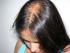 Causas de la caída del cabello
